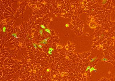 20091013144642-cellcount.jpg